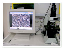 ペリオセーバー　細菌顕微鏡